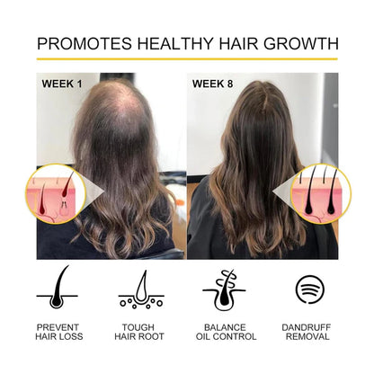 1+1 GRATIS | Grow Hair Essence
